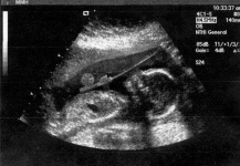 encontre mi ecografia ..jajaja // I found my ultrasound...haha